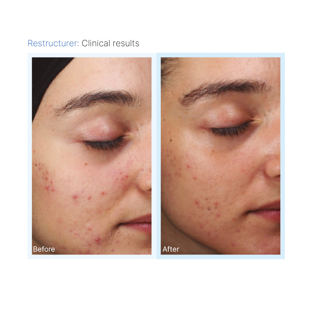 Blemiderm® Pack