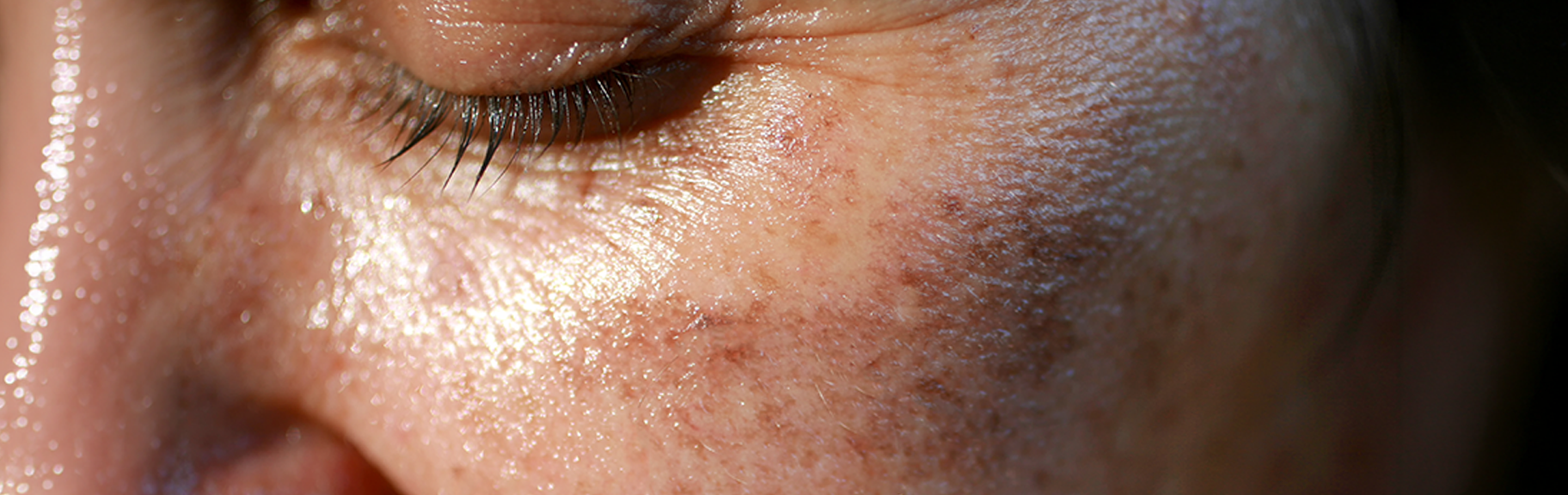 Why Stubborn Pigmentation Is Not a Problem — It's an Unfinished Protocol