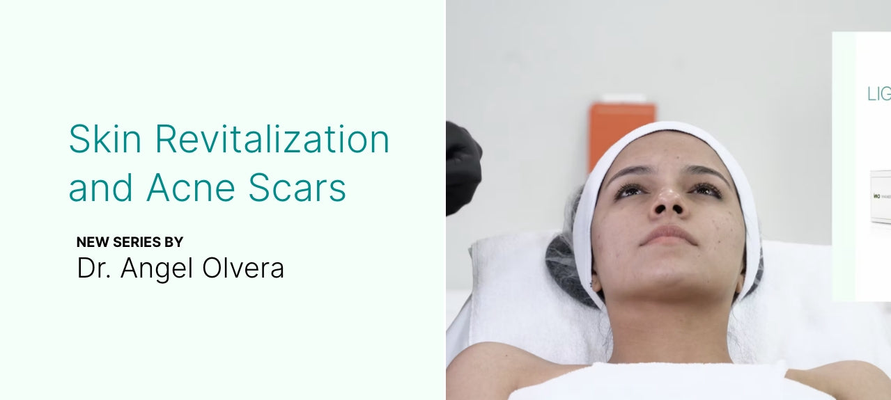 Skin Revitalization and Acne Scars