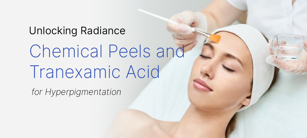 Chemical Peels and Tranexamic Acid for Hyperpigmentation