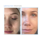 Lightening Mask