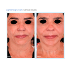 Lightening Mask