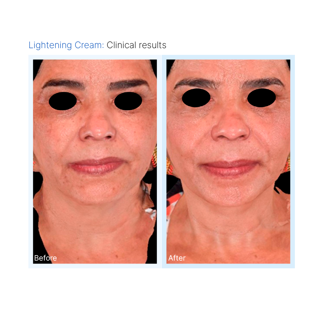 Lightening Mask