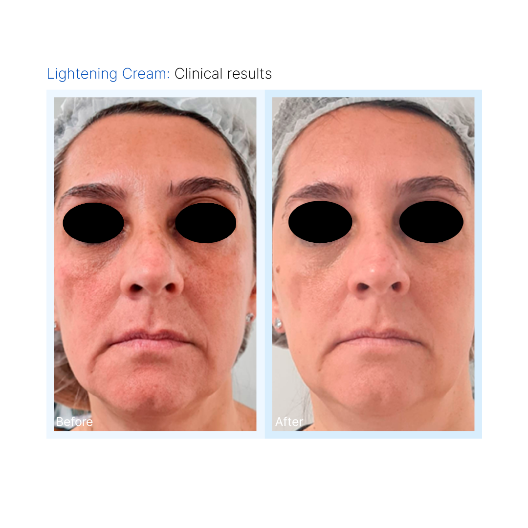 Lightening Mask