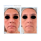 Lightening Mask