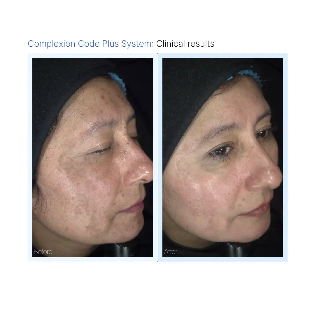 Complexion Code Mask