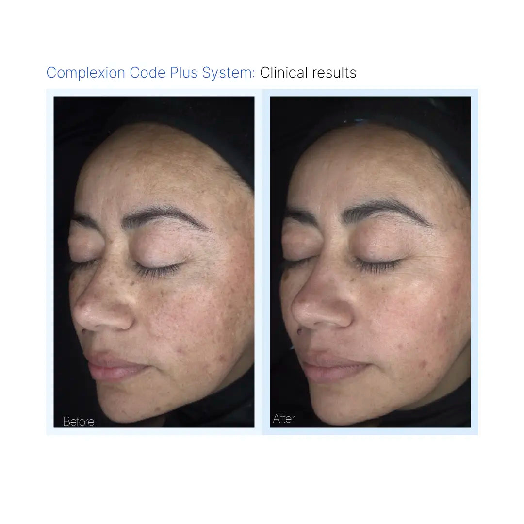 Complexion Code Mask