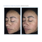Complexion Code Mask