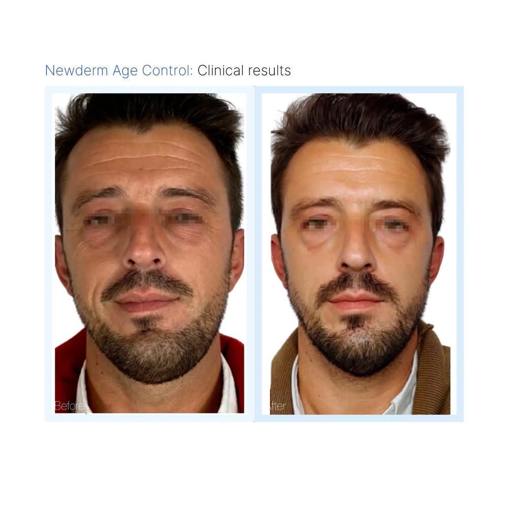 Newderm Age Control