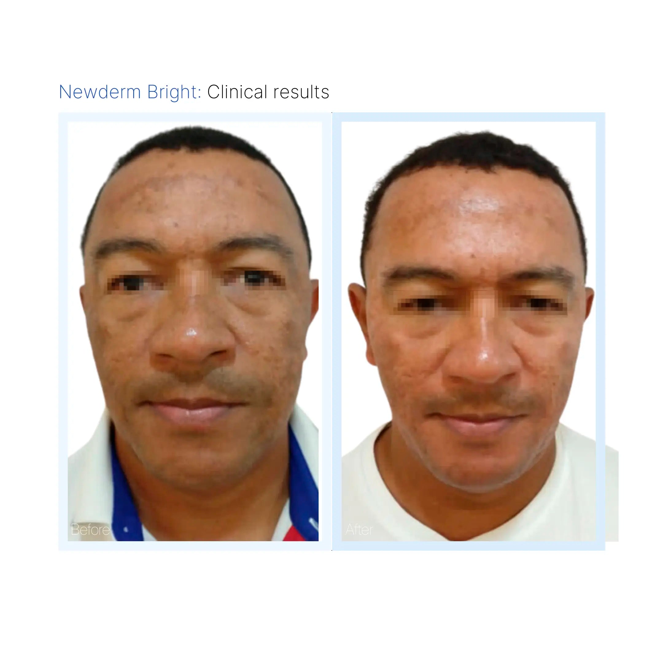 Newderm Bright