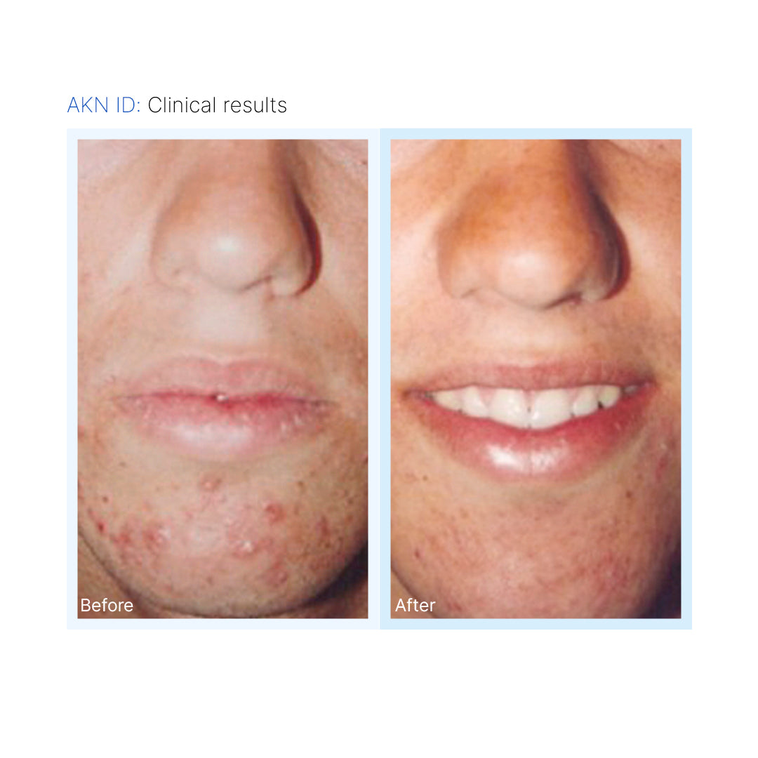 AKN-ID