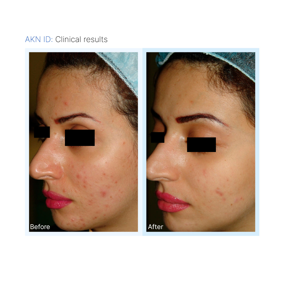 AKN-ID