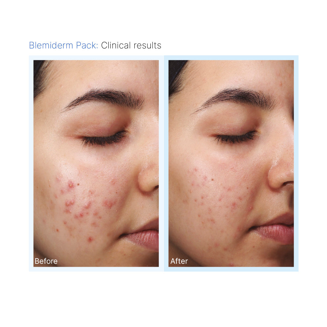 Blemiderm® Pack