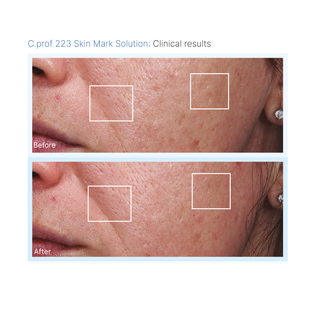 C.PROF 223 Skinmark Solution