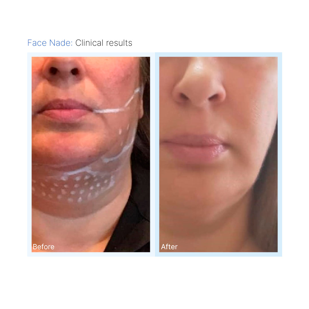Face Nade