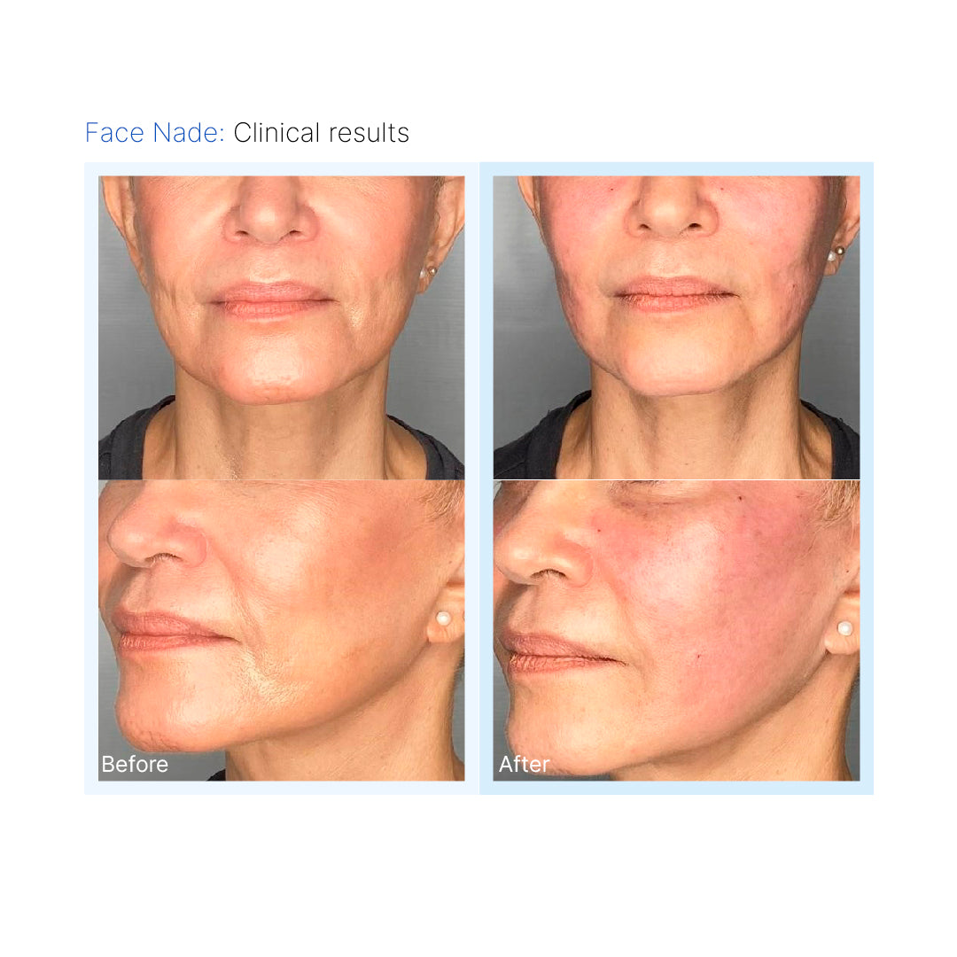 Face Nade