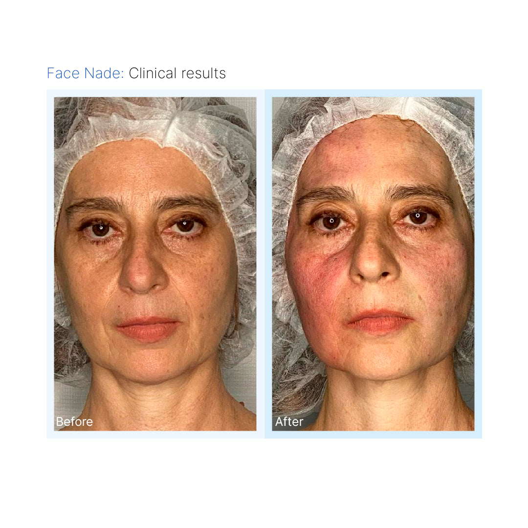 Face Nade