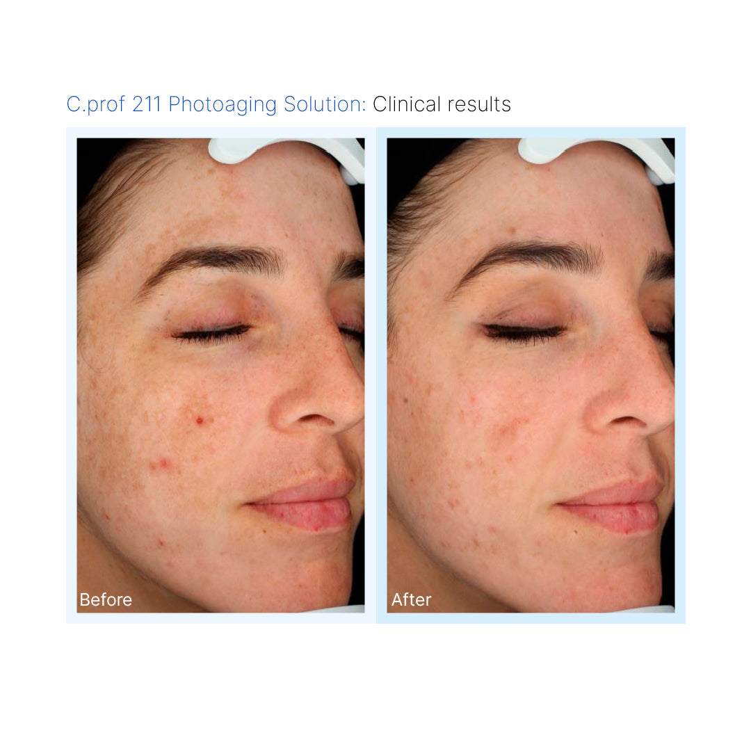 C.PROF 211 Photoaging Solution