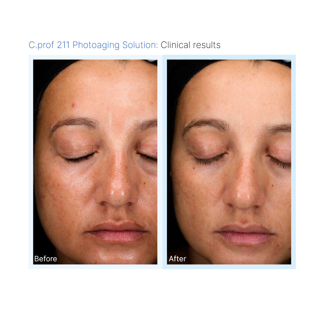 C.PROF 211 Photoaging Solution