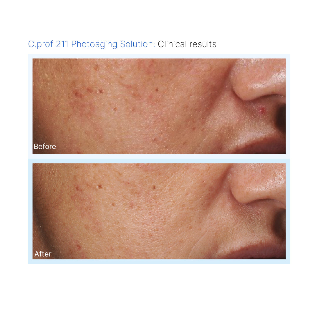 C.PROF 211 Photoaging Solution