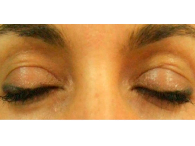 Antes